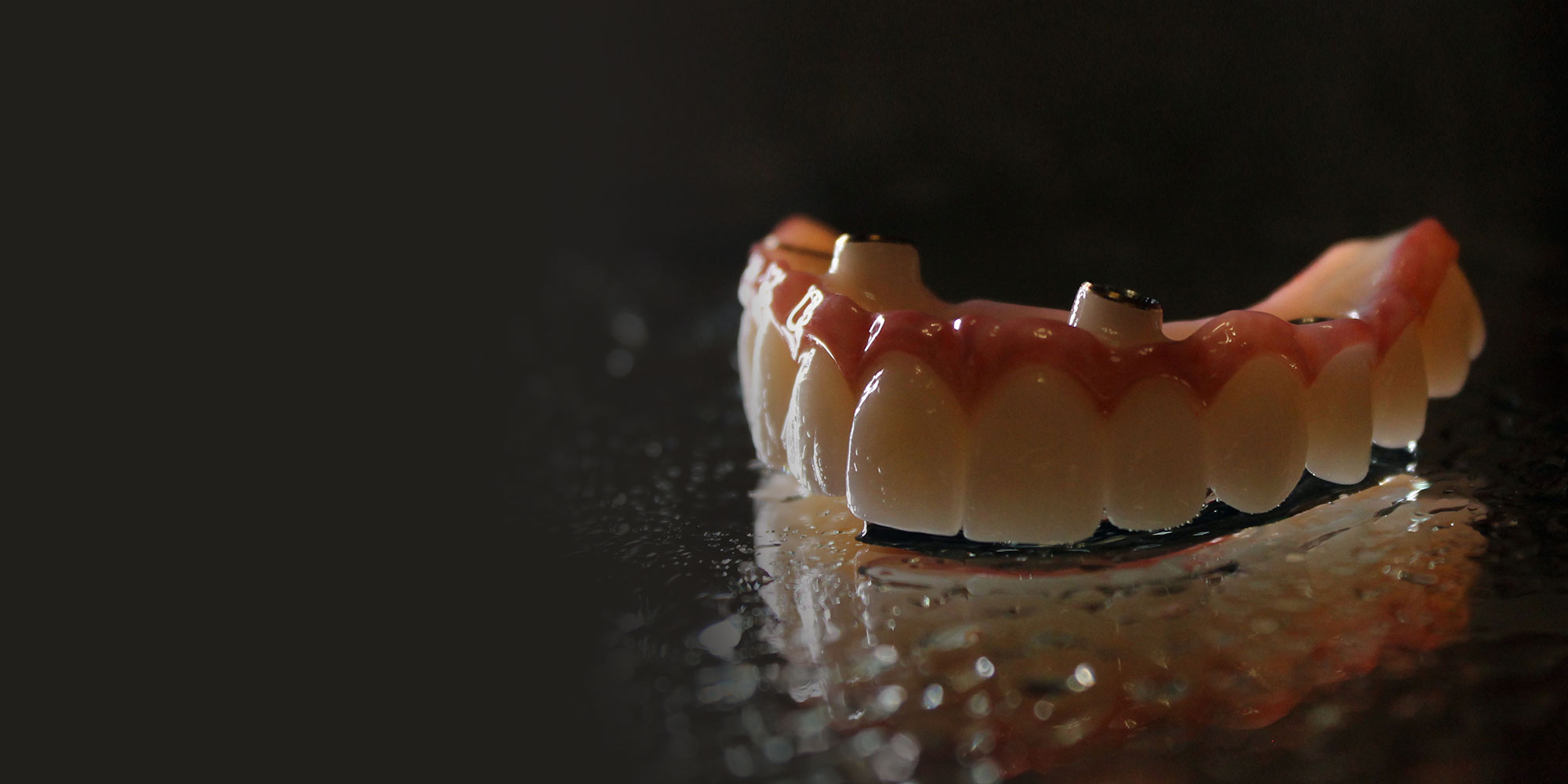 Discover Durable Fixed Zirconia Bridges in Cape Coral, FL